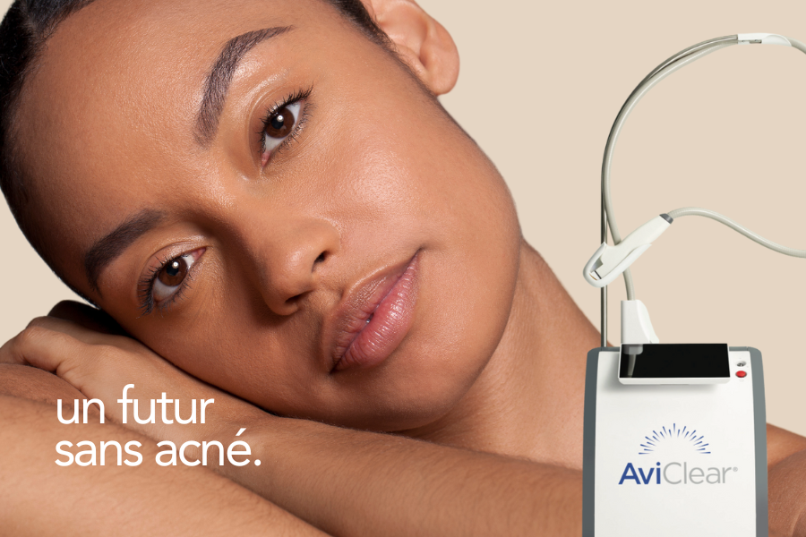 protocole acné avec laser aviclear visage