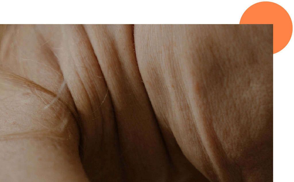 peau du cou détendue et cellulite faciale