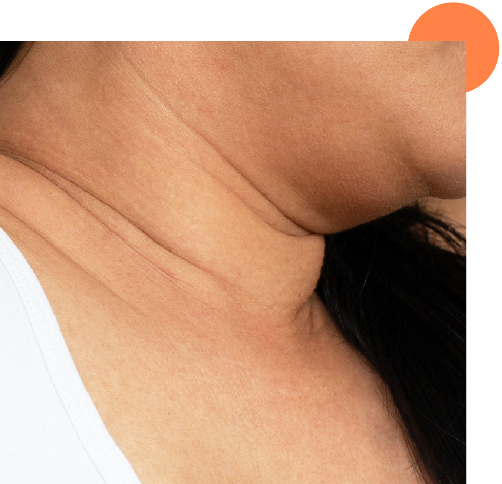 zoom sur plis du cou et double menton