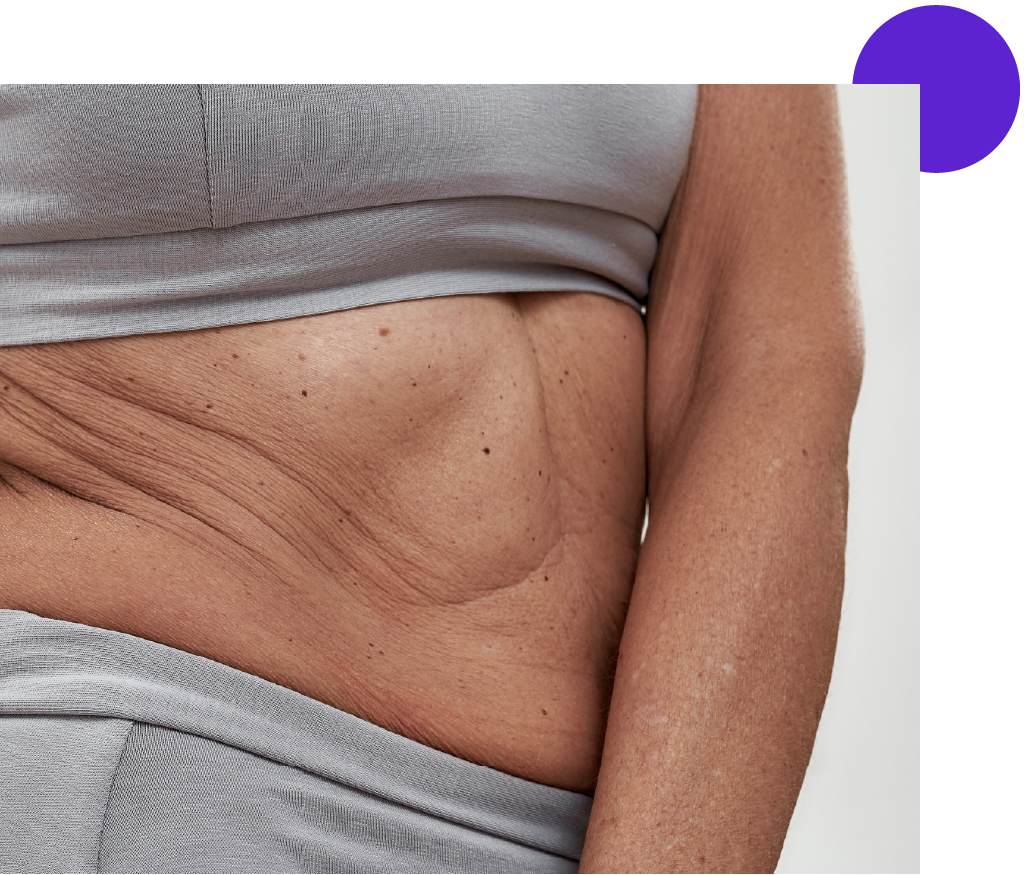 zoom sur un ventre avec petits bourrelets