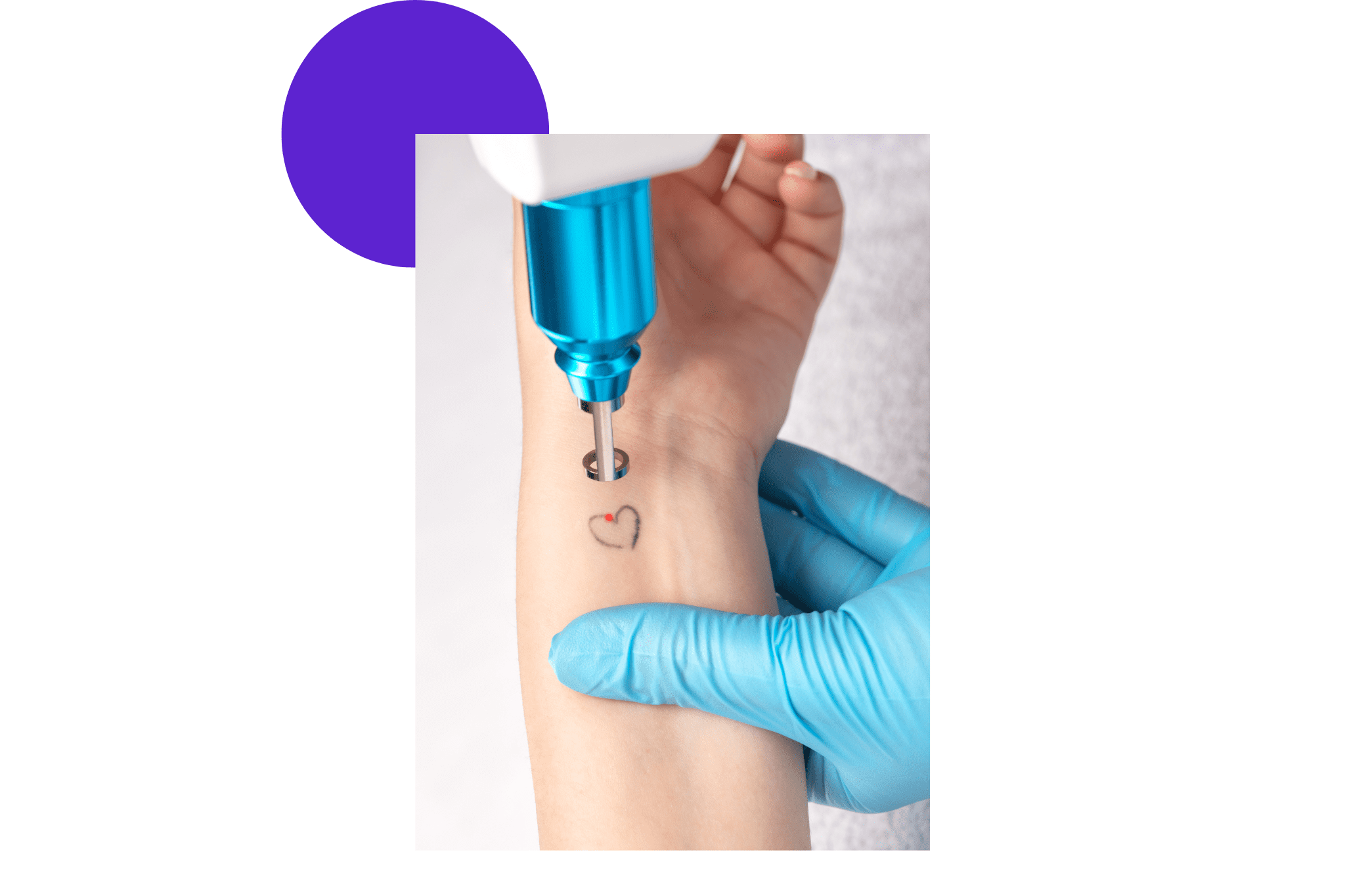 DeÌtatouage sur l'avant bras d'un coeur