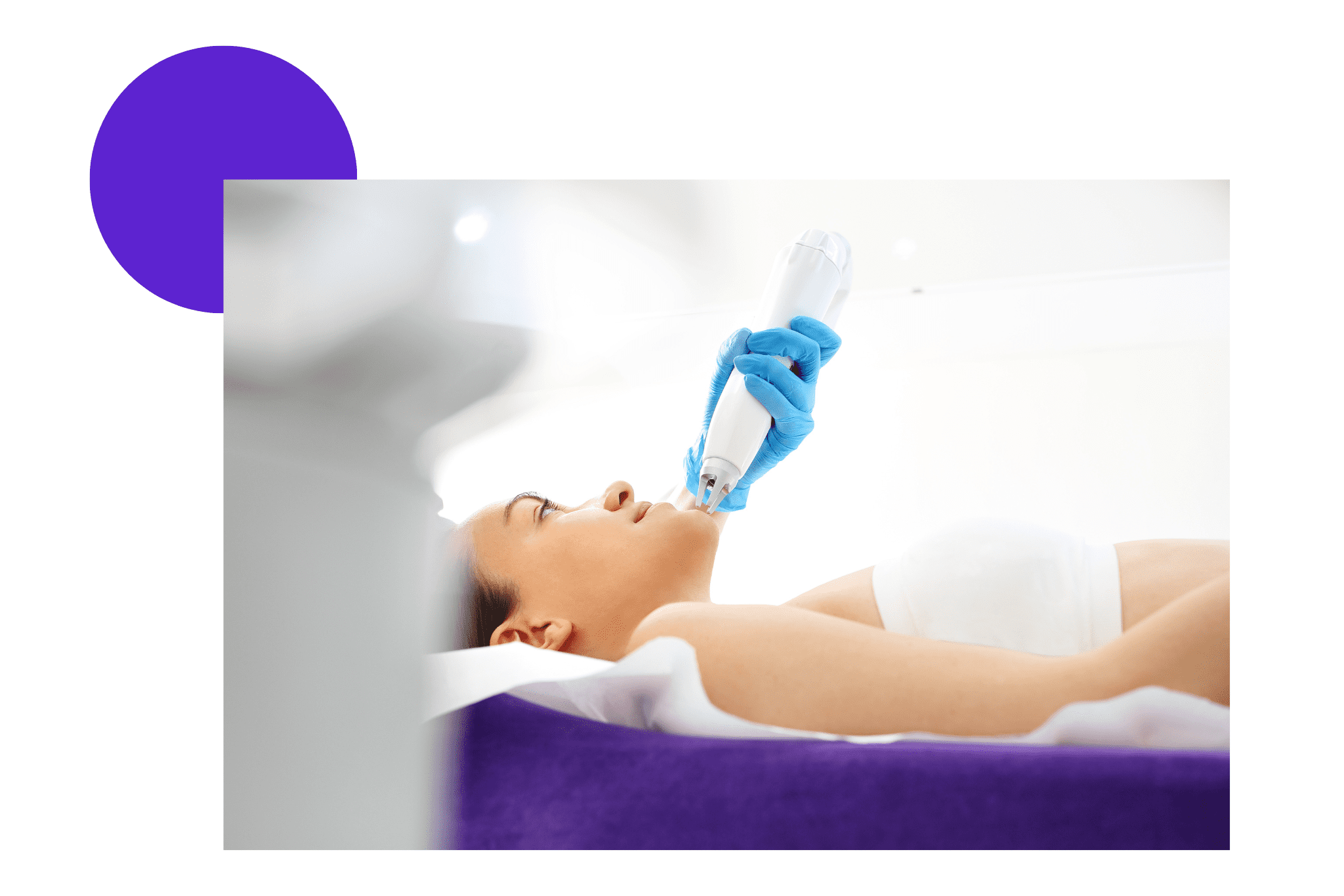 Épilation laser du menton d'une femme