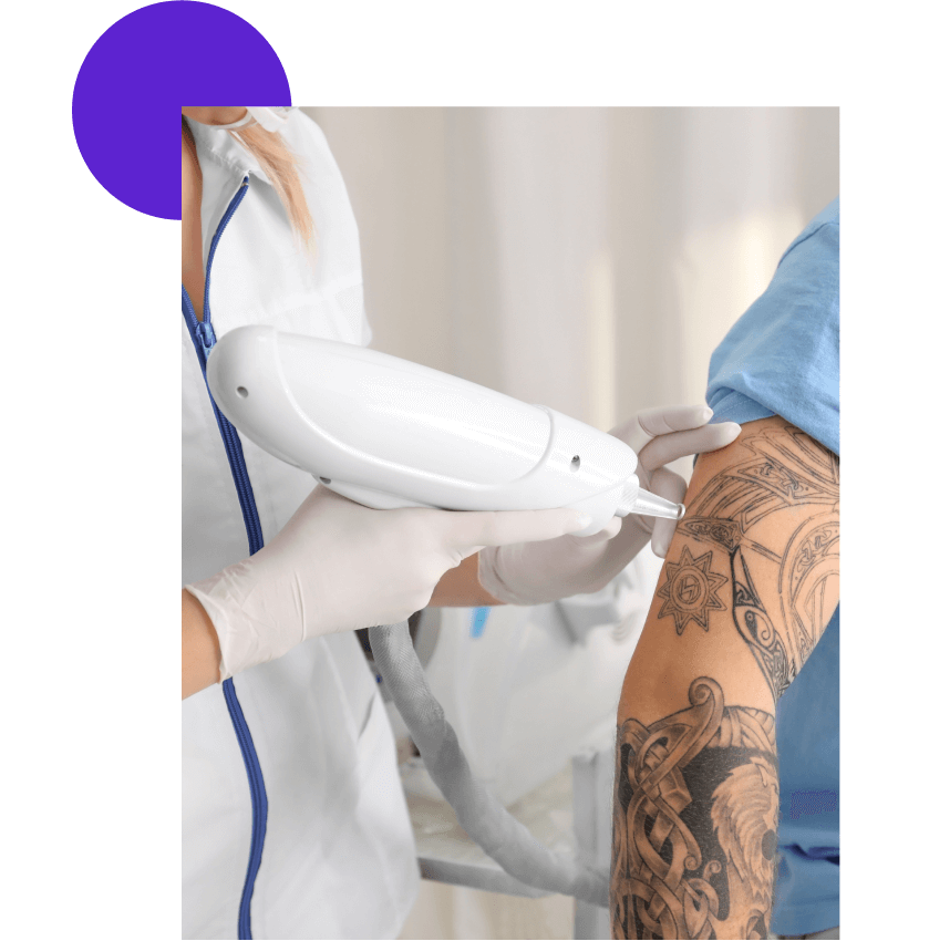 médecin qui réalise du laser sur un tatouage homme