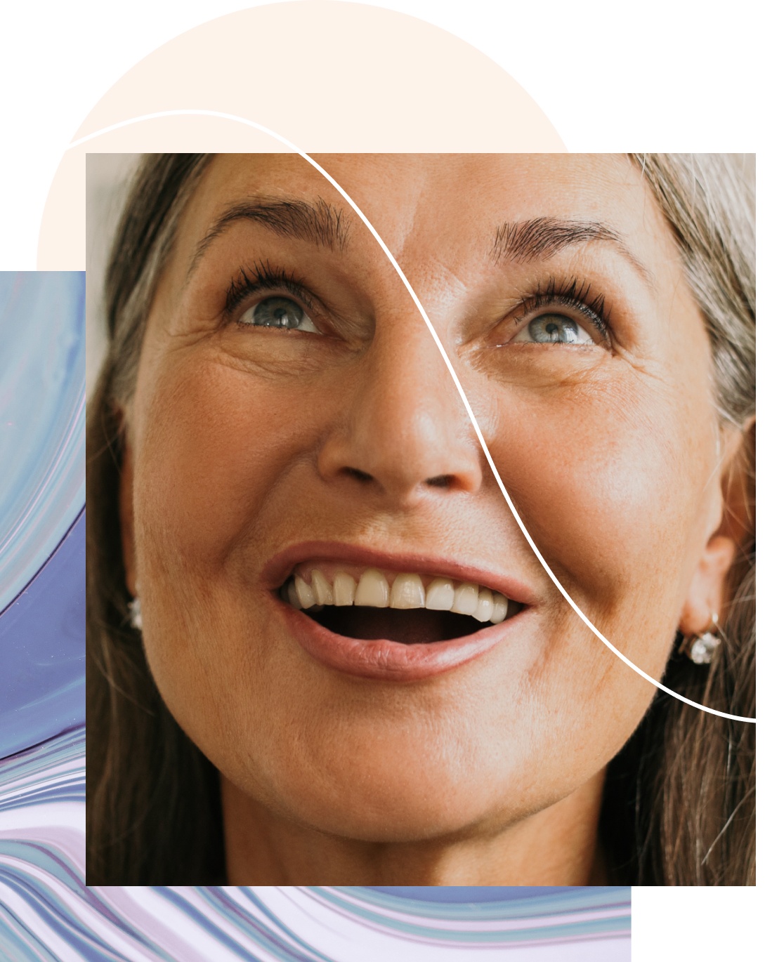 femmes souriant après son soin contre les rougeurs du visage