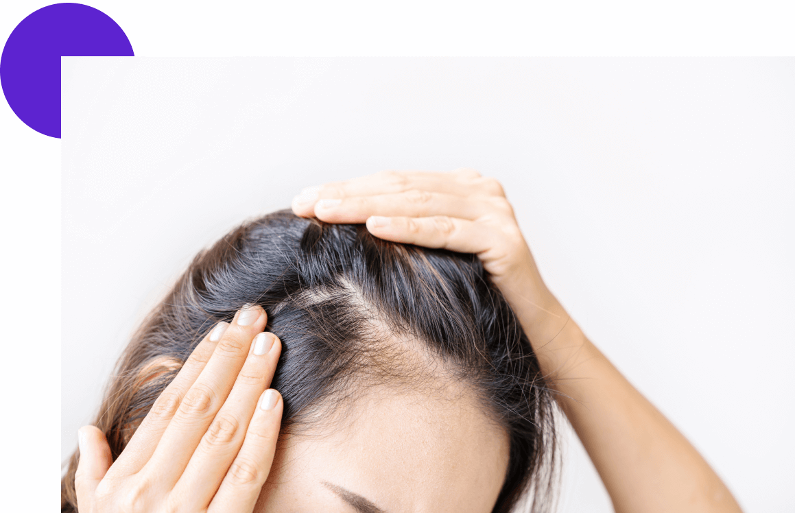 Lignes frontales cheveux