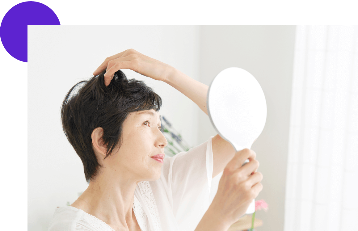 femme qui regarde son stade d'alopécie selon l'échelle de Norwood