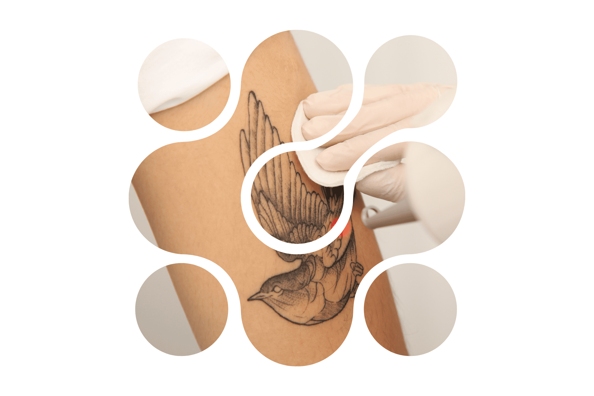 Picto FAQ détatouage