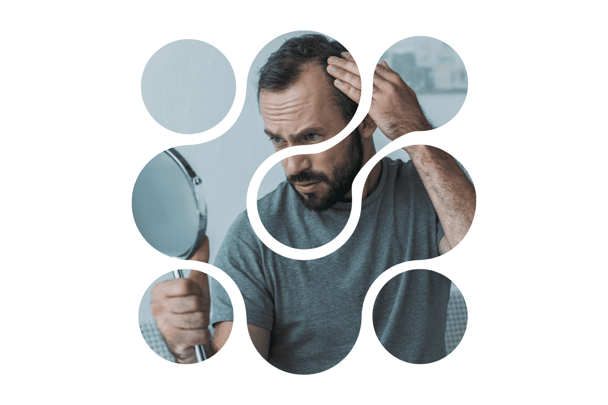 Picto calvitie masculine