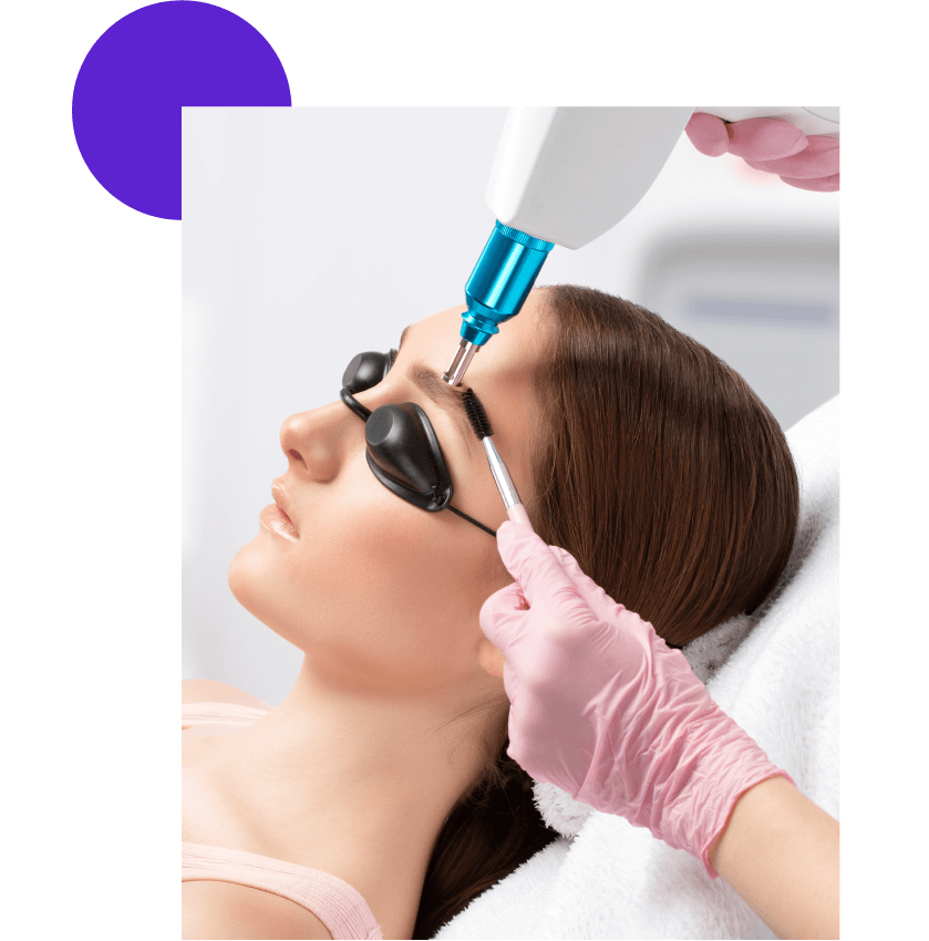 Séance de détatouage microblading au laser