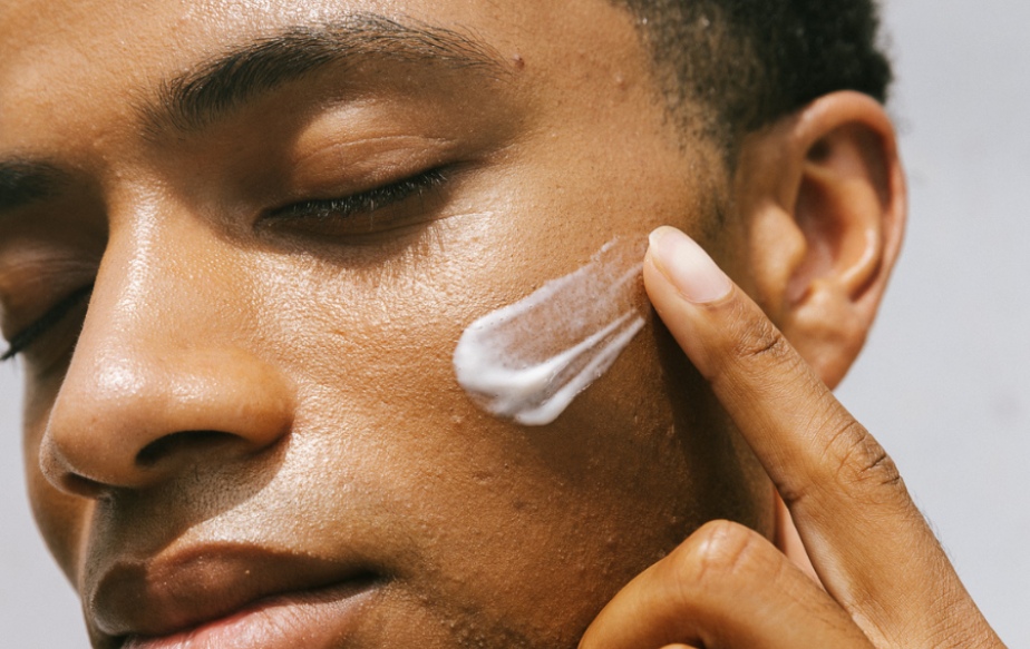 acné sur un homme noir