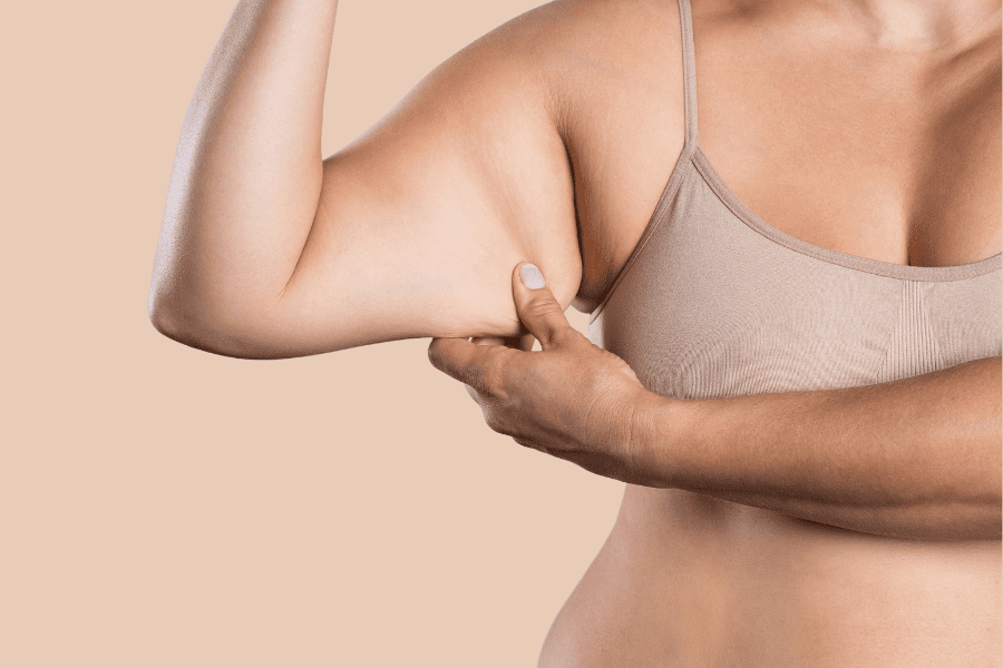 Une femme qui pince son bras avec cellulite au niveau des triceps (batwings)