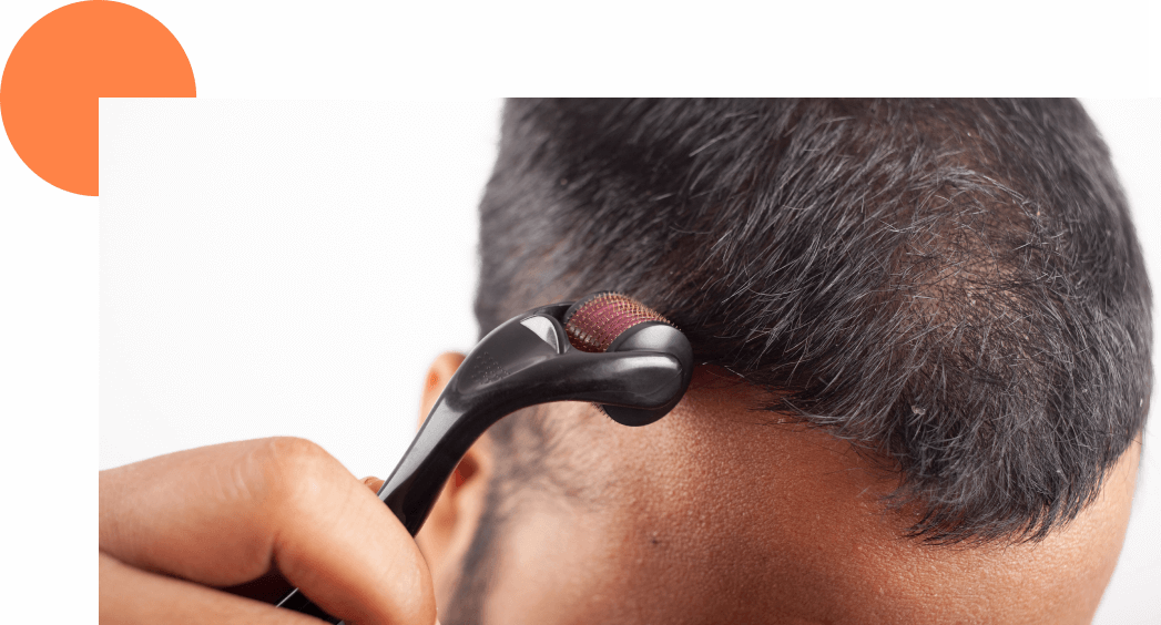 zoom sur dermaroller