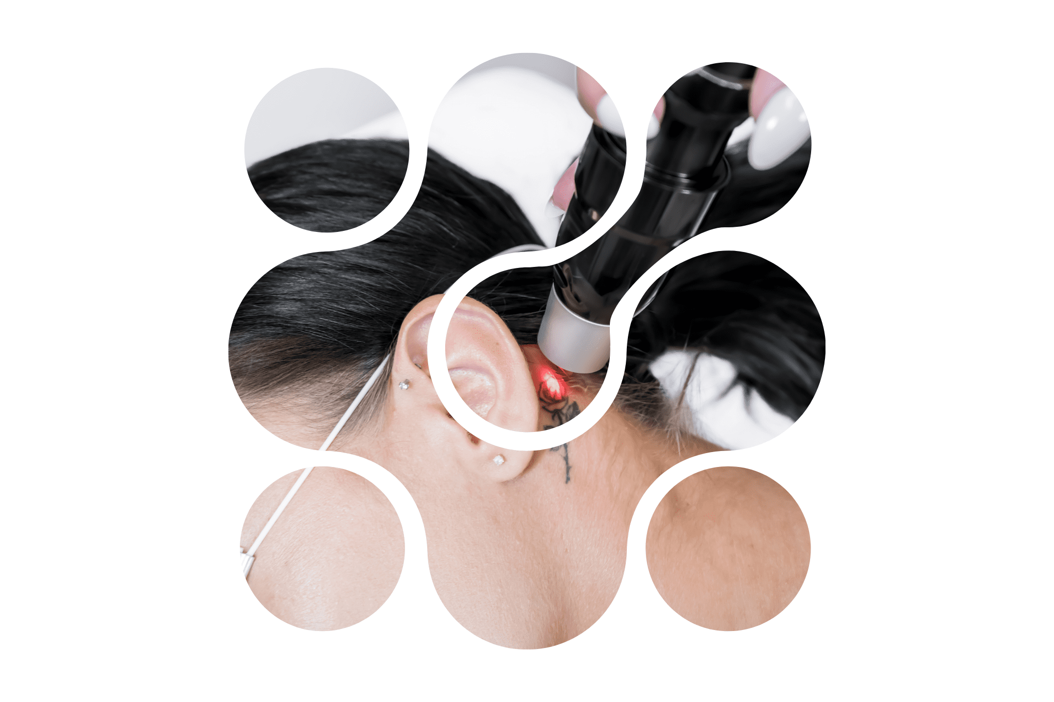 détatouage d'une rose derrière l'oreille d'une femme