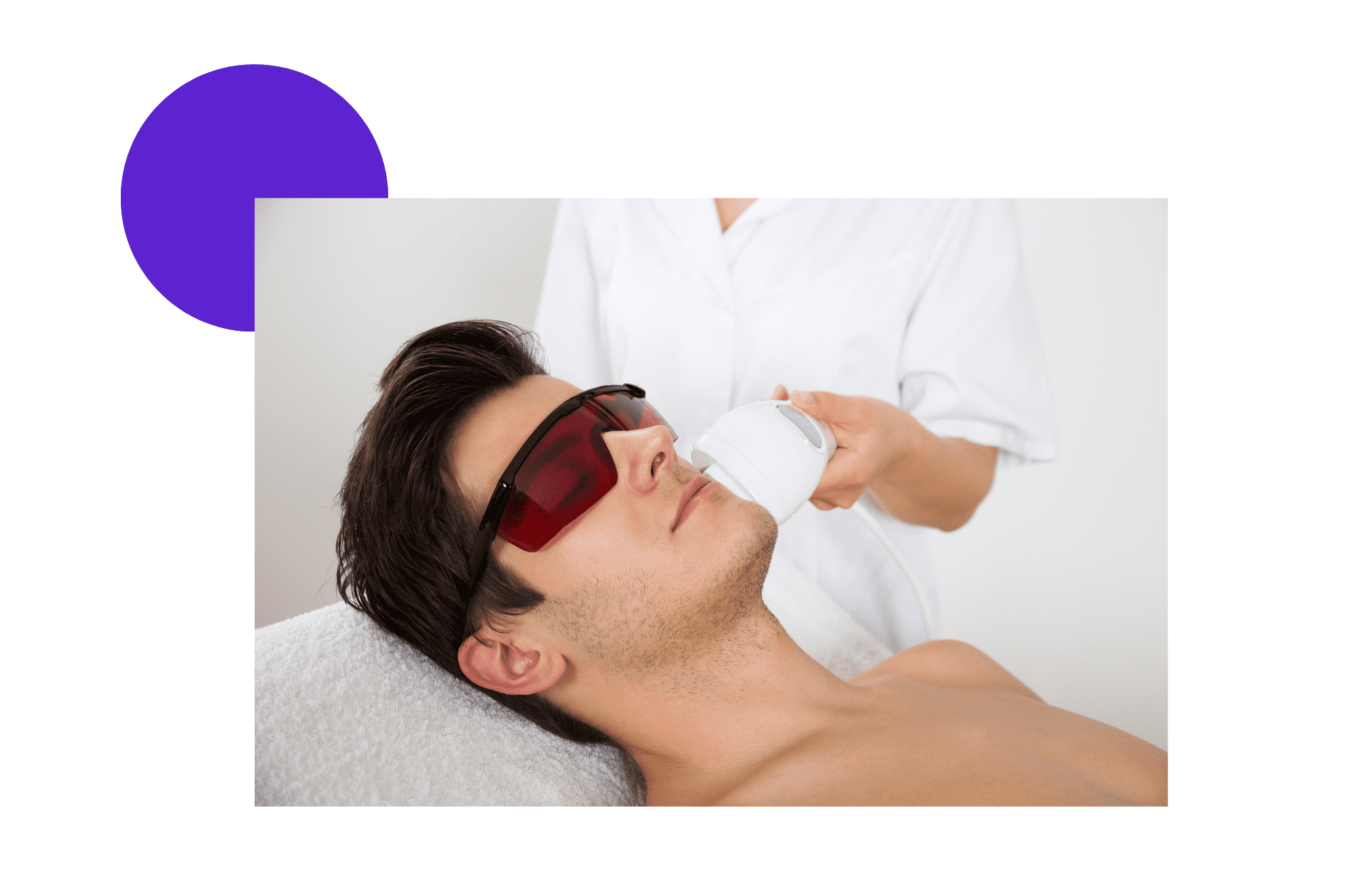 épilation au laser de la barbe d'un homme