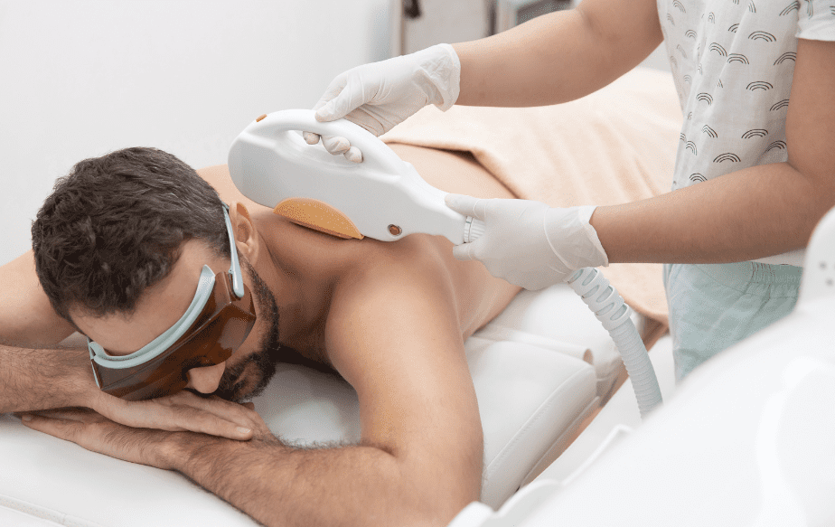 épilation laser du dos sur un homme
