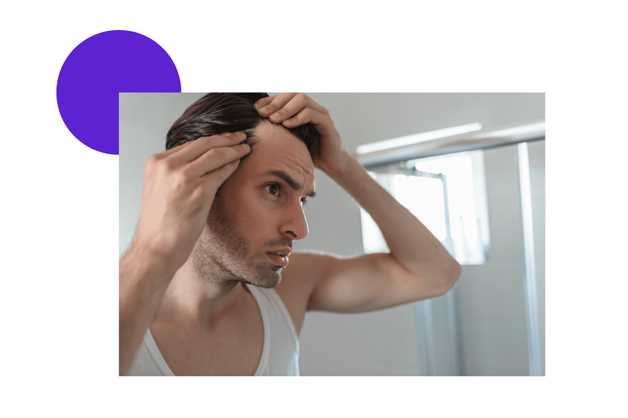 un homme qui subit la perte cheveux homme