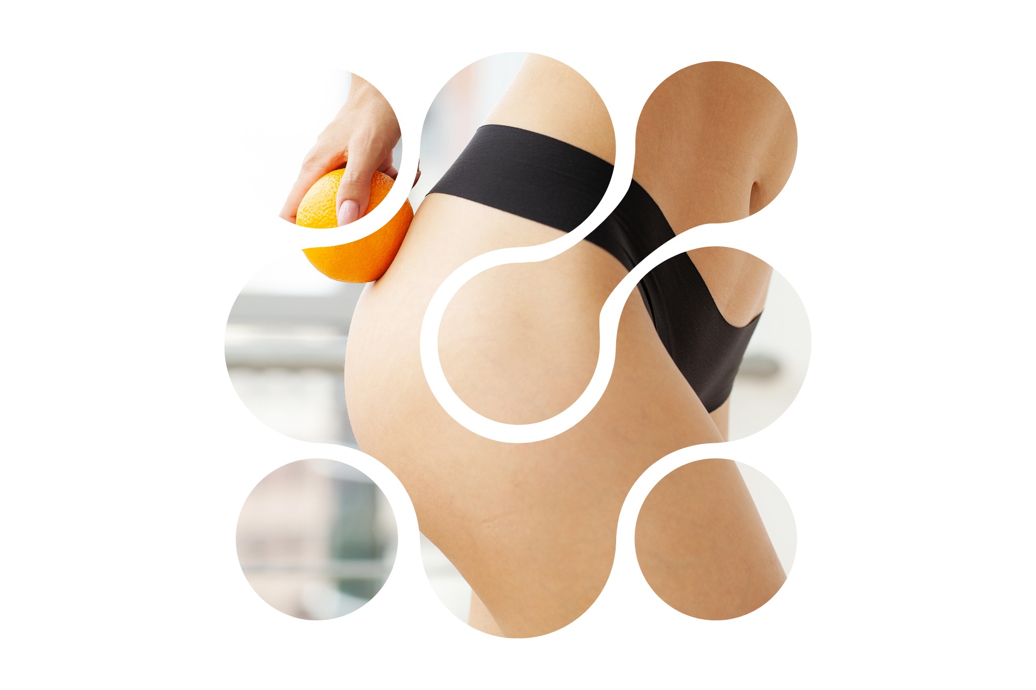 une femme qui a de la cellulite qui se demande comment maximiser les résultats de la cryolipolyse