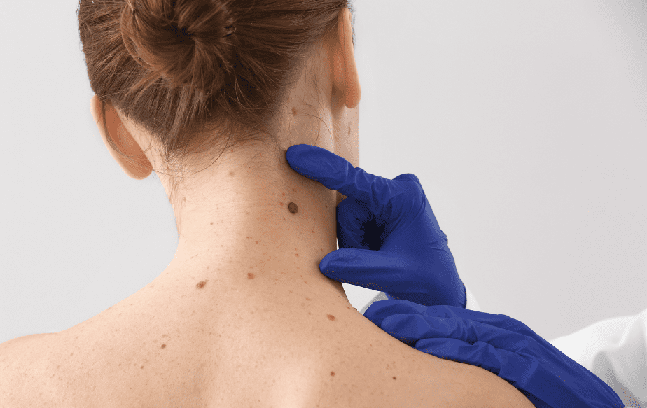 médecin qui analyse les grains de beauté sur la nuque d'une femme