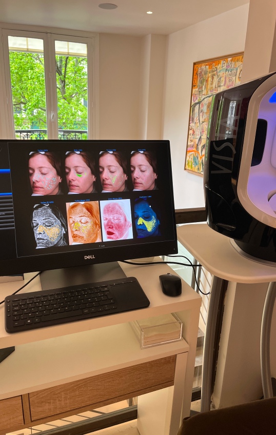 résultats des images prises par le visia