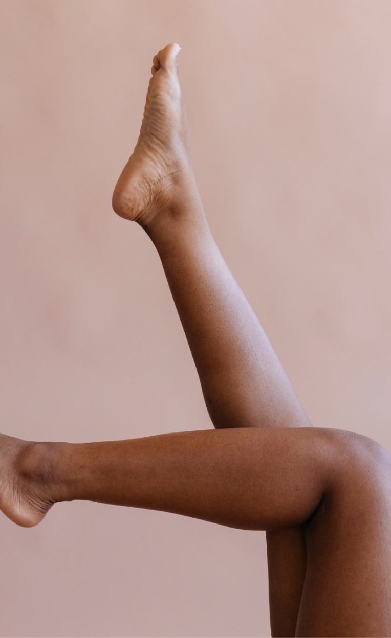 femme noire qui a fait des séances d'épilation laser pour éviter la repousse des poils