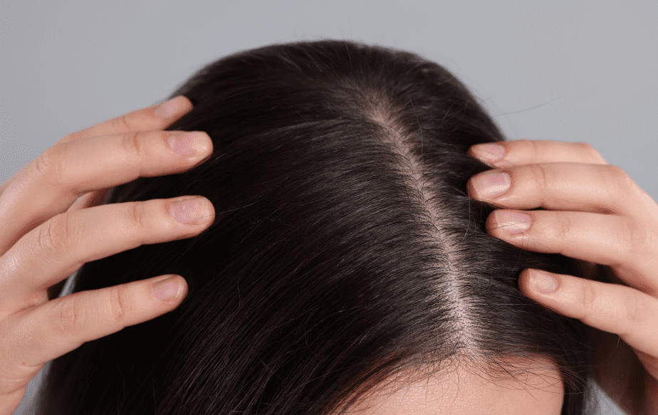 Une femme qui masse son cuir chevelu pour favoriser la repousse de ses cheveux