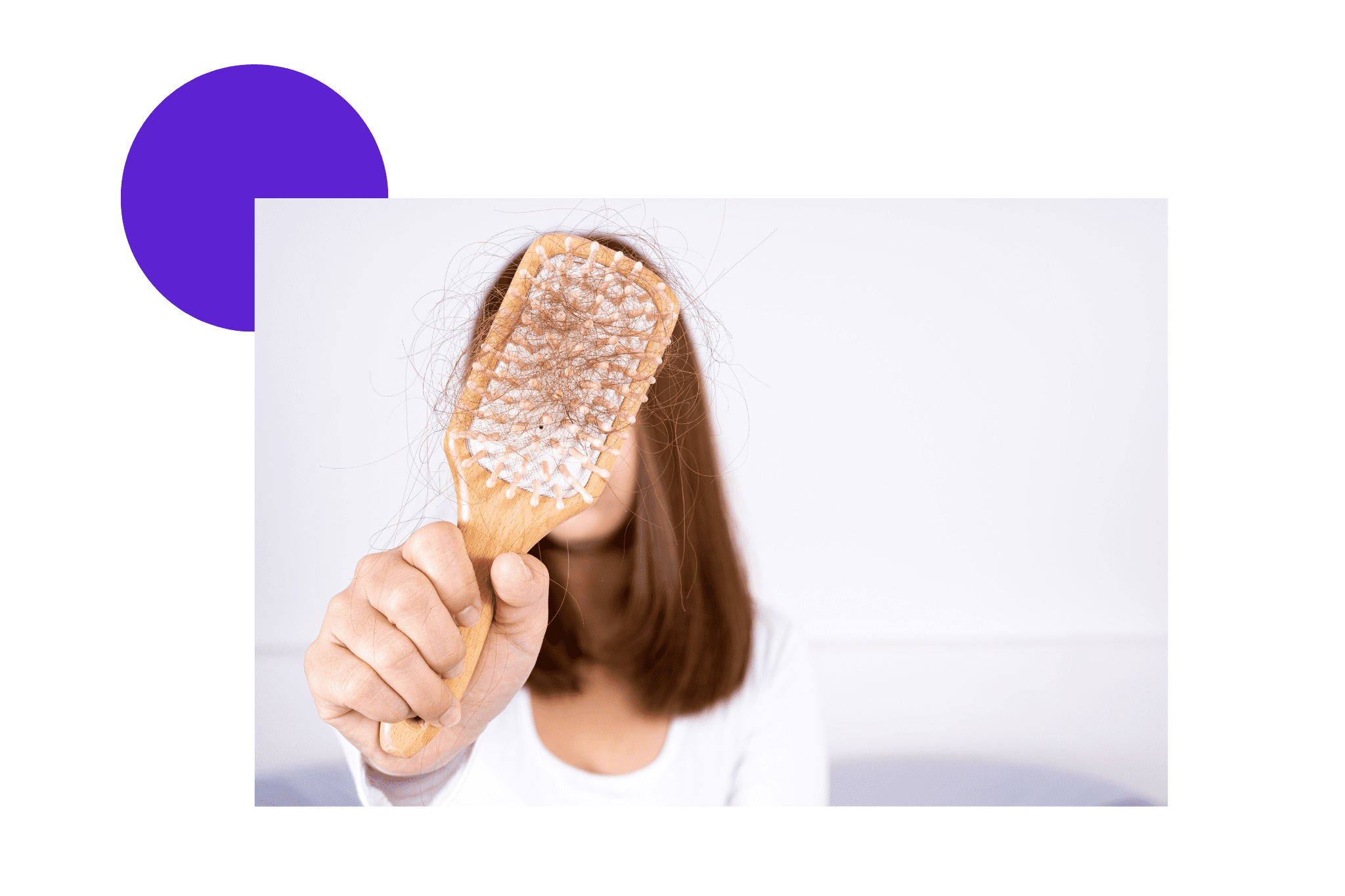 perte importante de cheveux femme