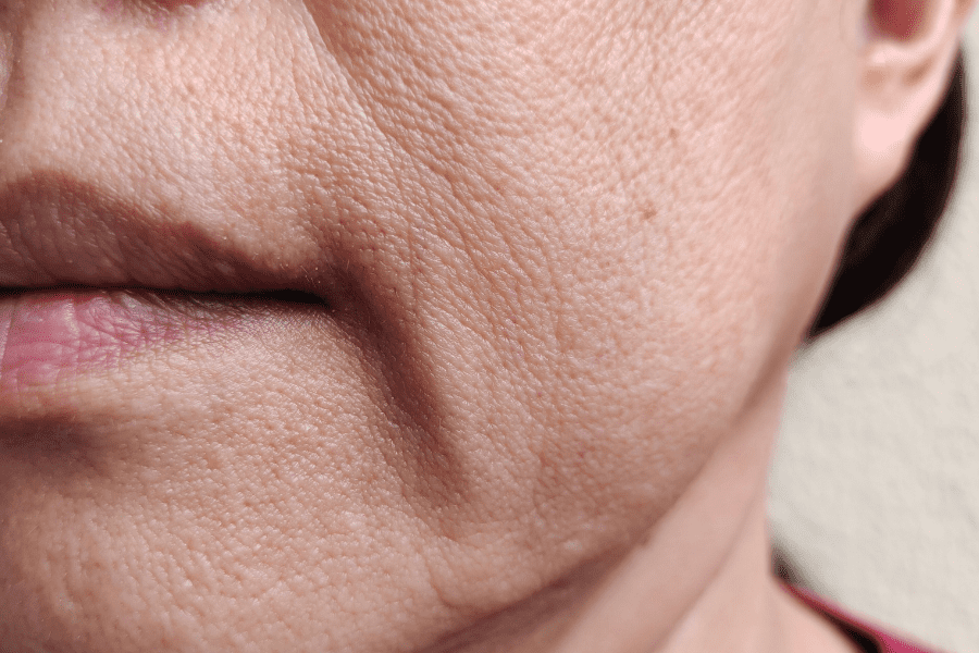 Femme avec plis d'amertume autour de la bouche