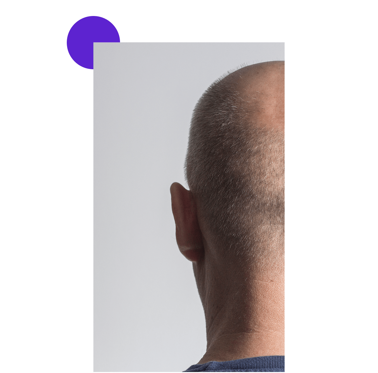 homme rasé au niveau des cheveux