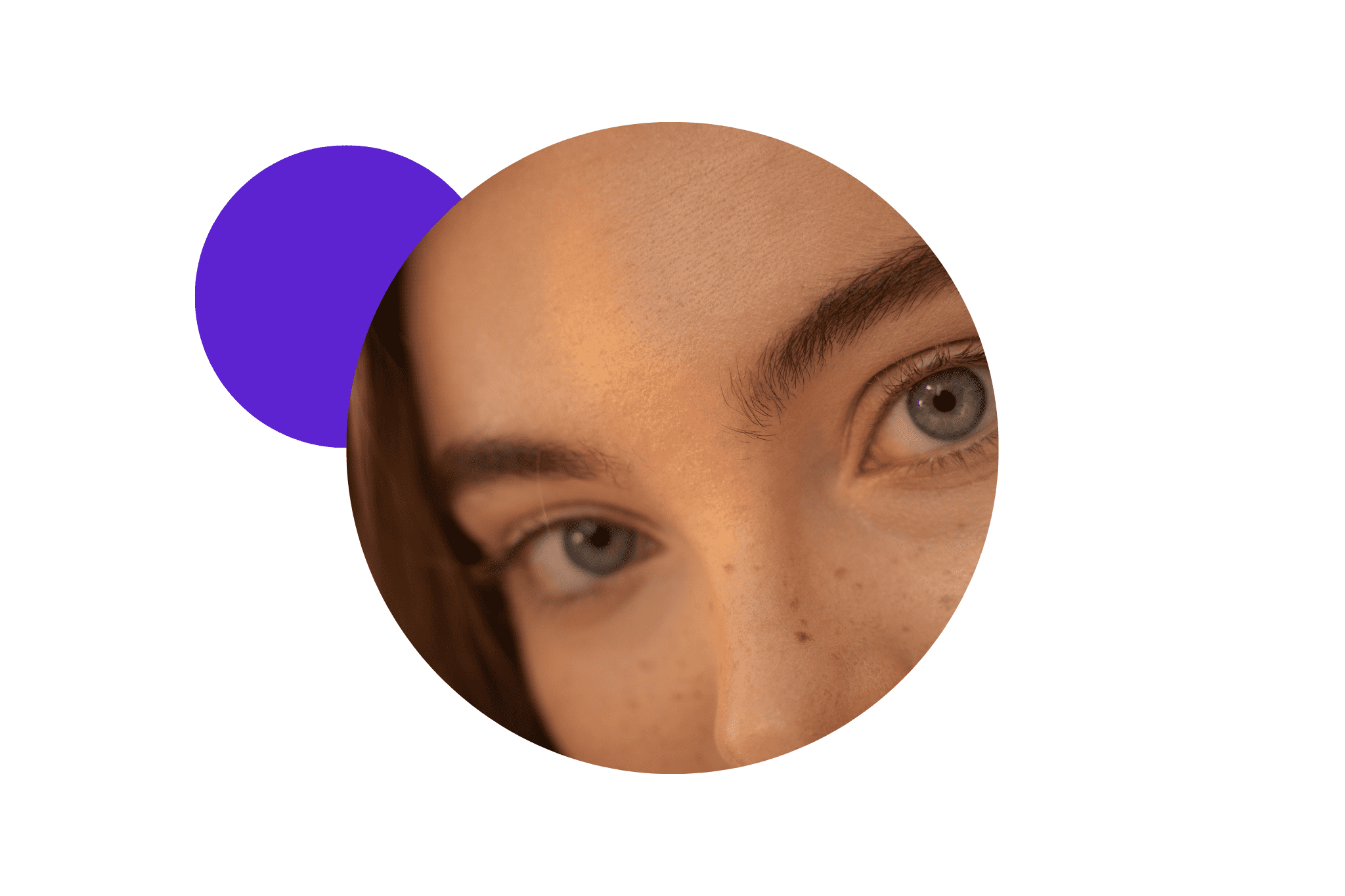 résultats naturels d'un soin au laser