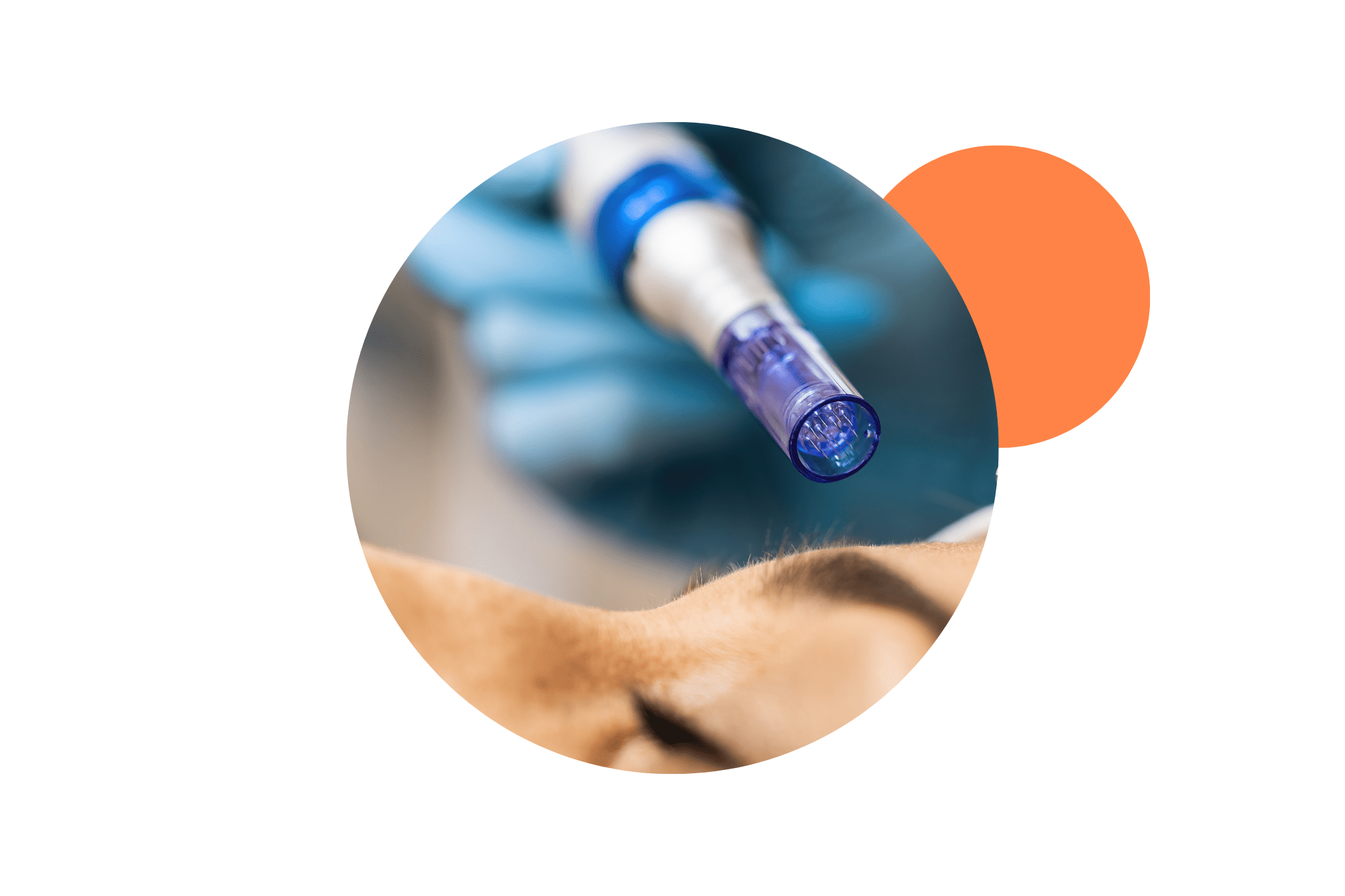 séance d'hydrafacial