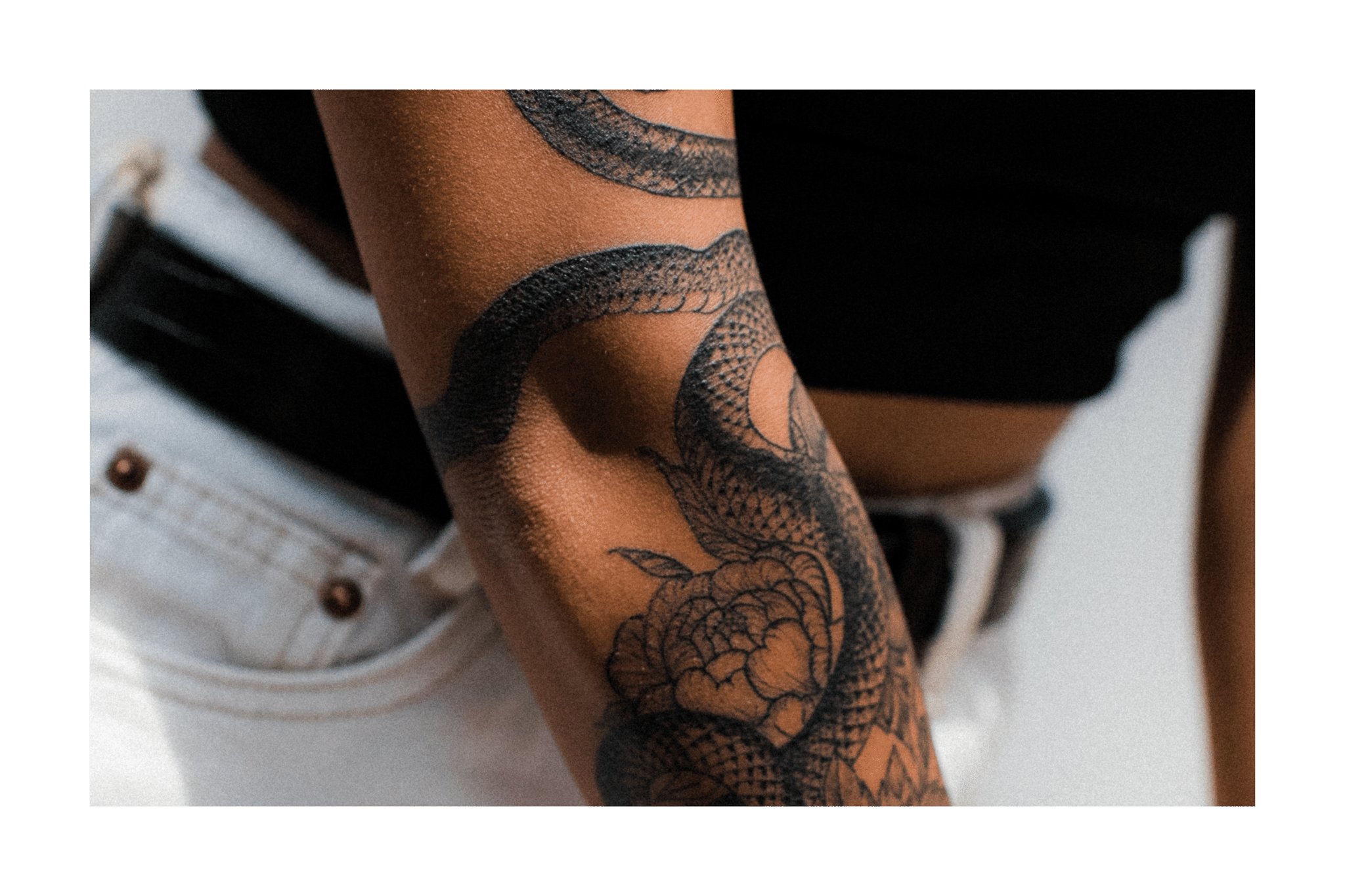 Zoom sur un homme qui a fait une séance de détatouage laser