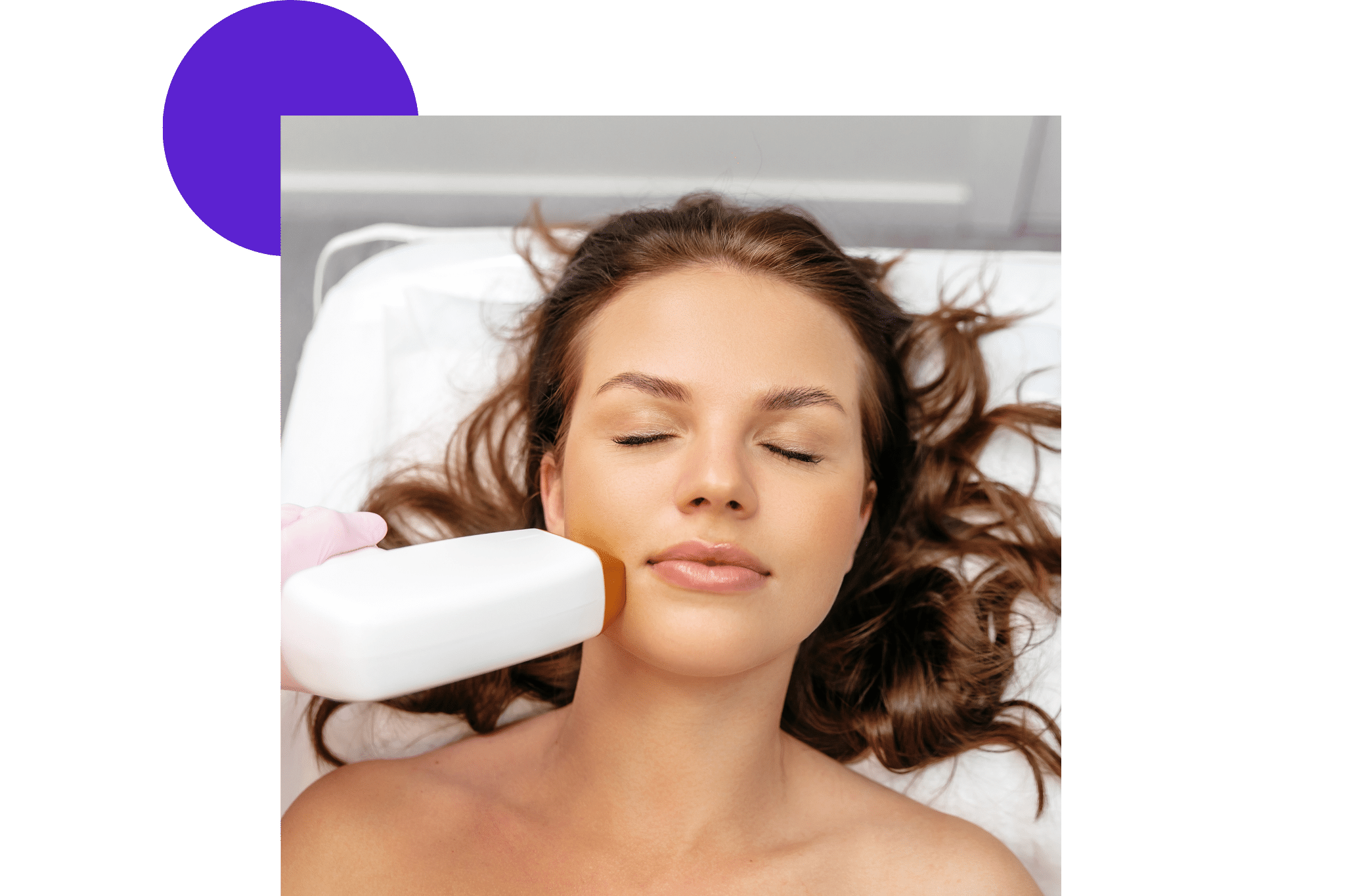 3eme séance epilation laser d'une femme