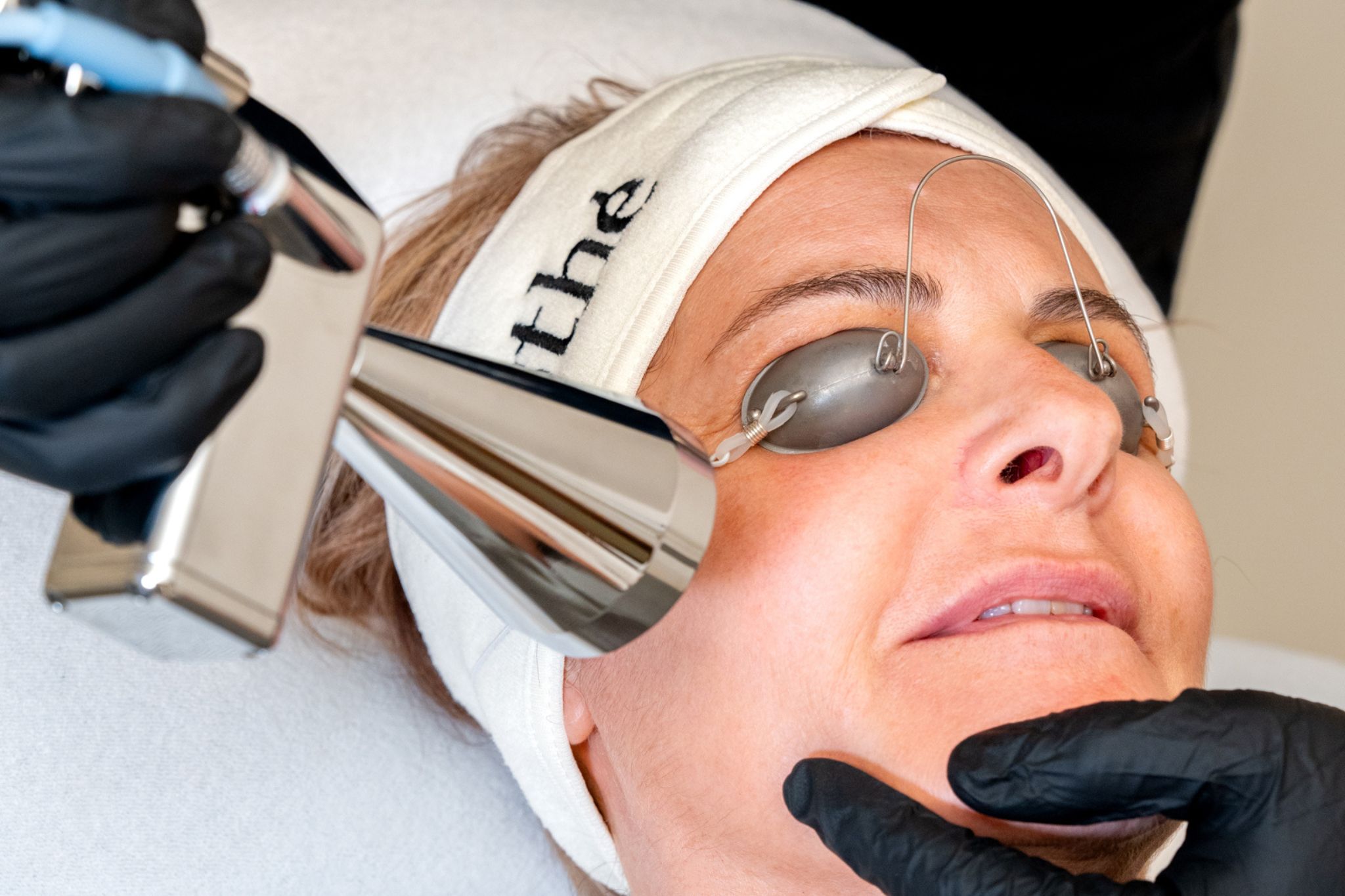 Séance de laser CO2 pour lisser la peau sur une femme âgée