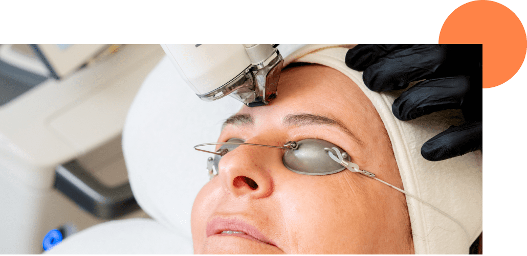 Zoom sur une séance de laser CO2