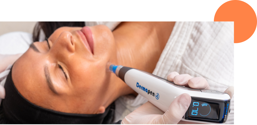 Séance de microneedling pour hydrater la peau en profondeur