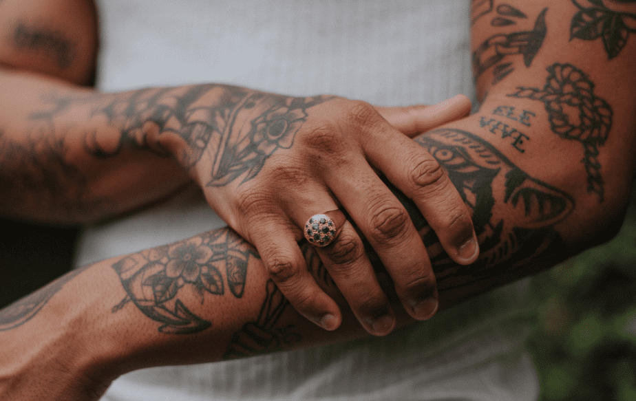 un monsieur qui souhaite enlever son tatouage fait à l'encre de chine