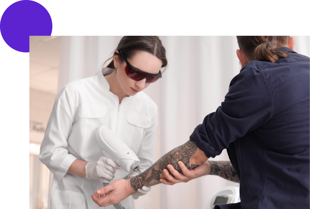 séance de détatouage sur l'avant-bras